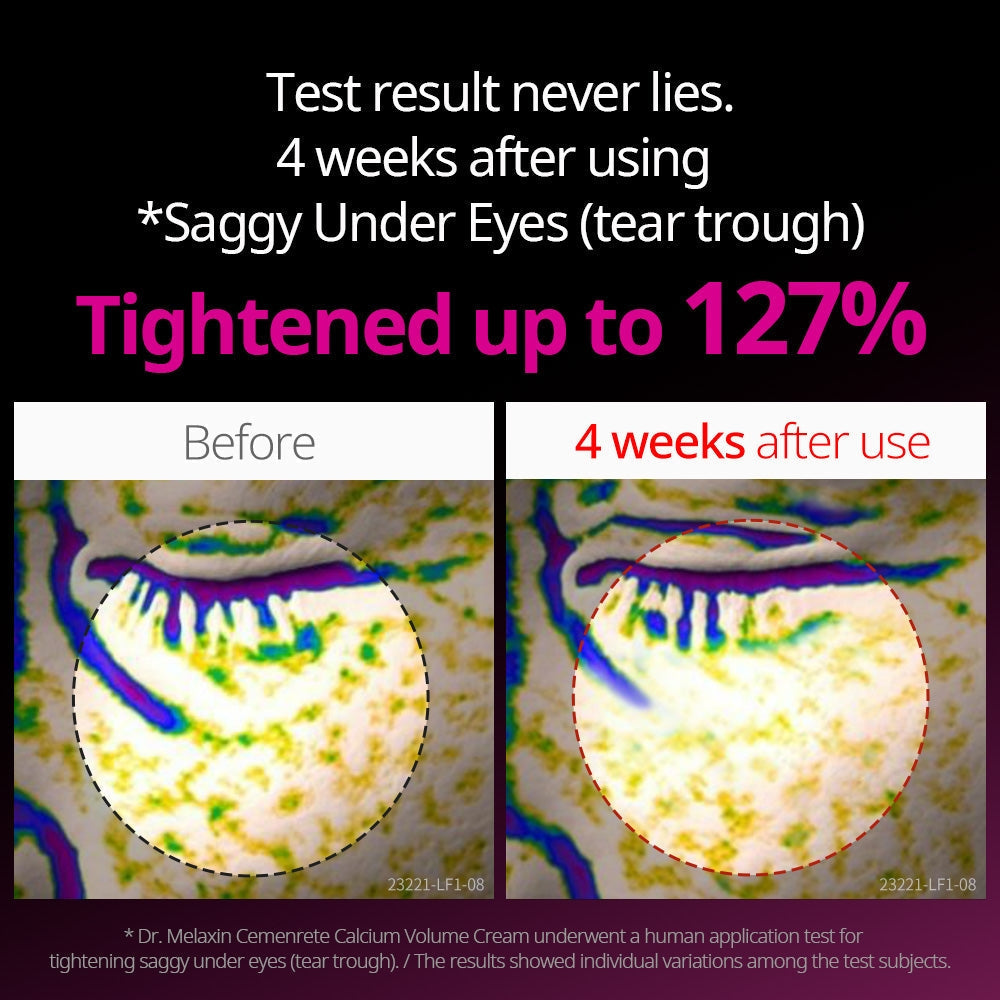 Dr.Melaxin Cemenrete Eye care Line