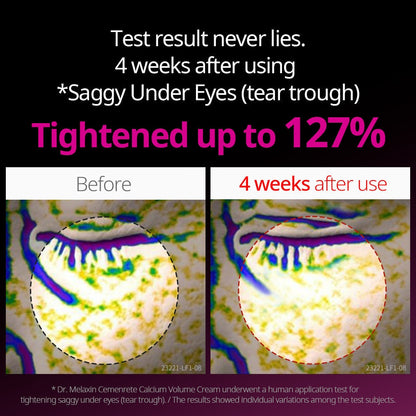 Dr.Melaxin Cemenrete Eye care Line