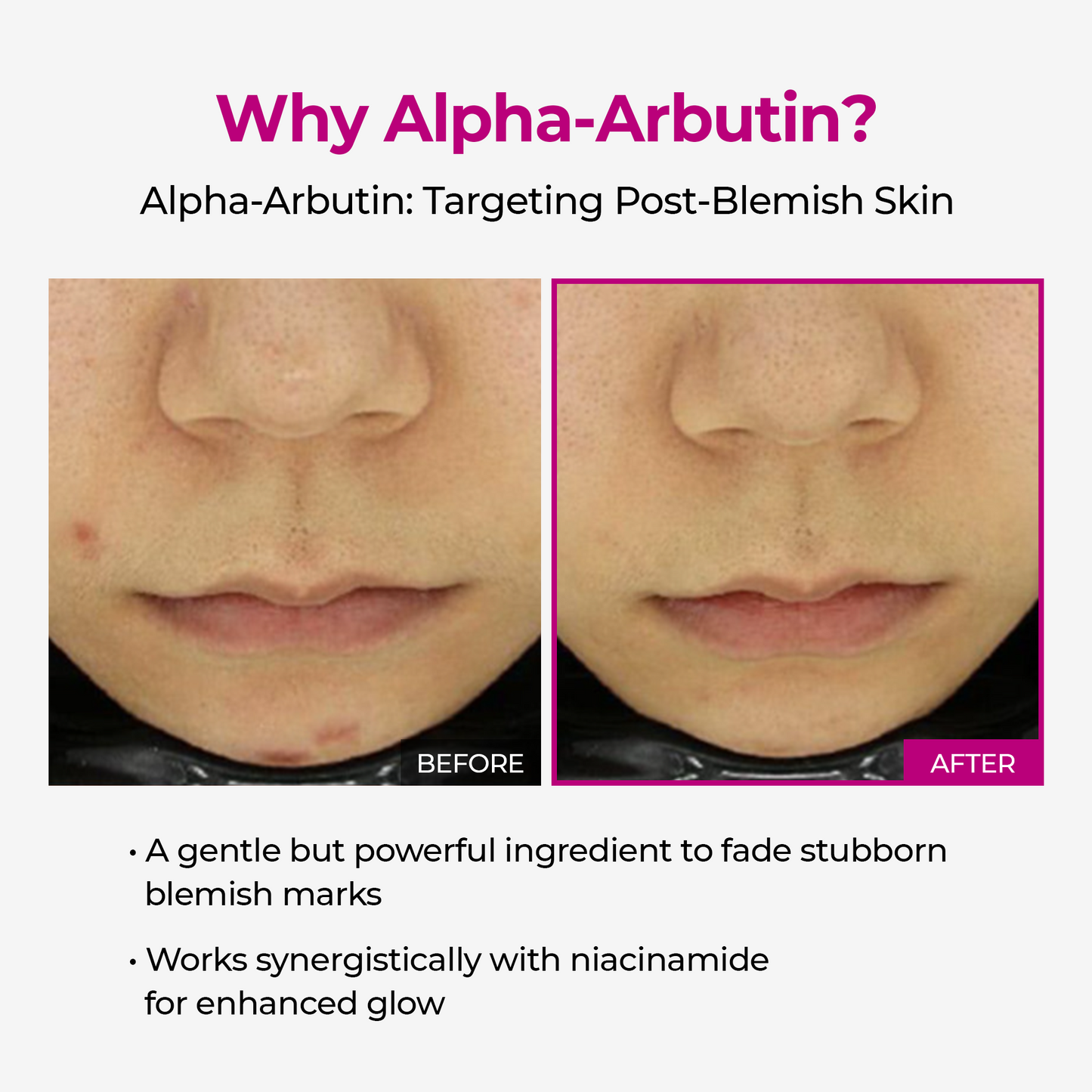 Dr. Melaxin Cemenrete Ultimate Calcium Eye Care Set – Multi Balm, Calcium Eye Patches & Complete Eye Care Line for Firming, Brightening & Anti-Aging Under-Eye Treatment